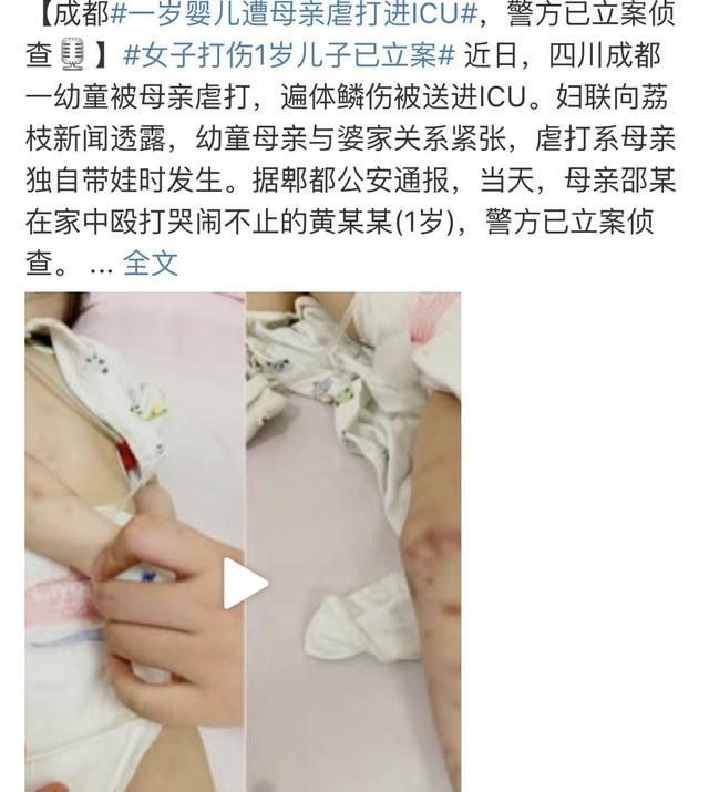  屁股|虽然孩子身上这4个部位不能打，但火气上来了，这个地方可以试试