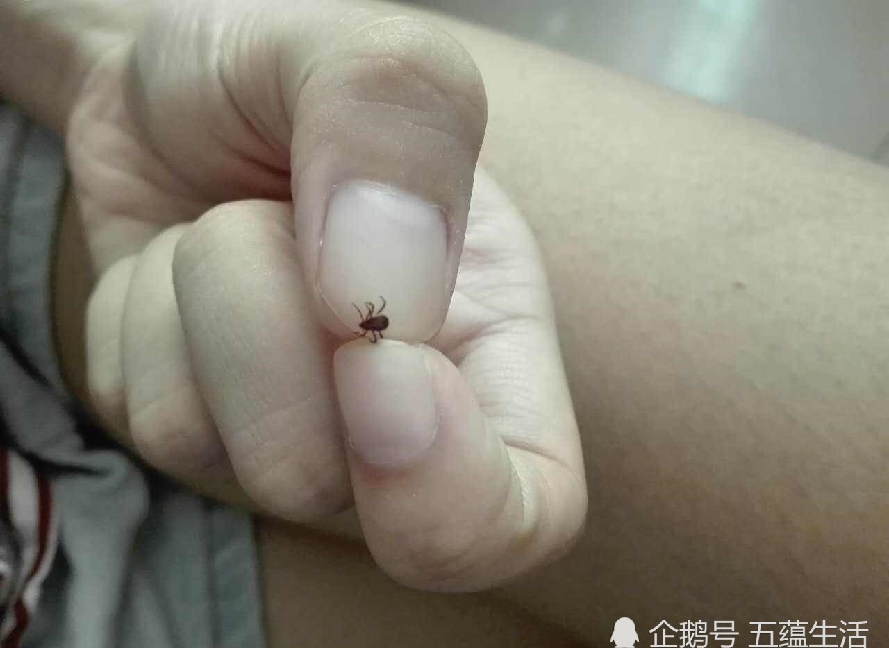 中医|打败拿破仑的“生物武器”,中医1700年前就已破解,错失诺贝尔奖