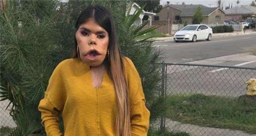 少女|印度少女因长相神似猴头走红,被富豪明媒正娶回家后,现怎样?