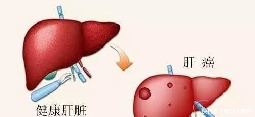 伤肝行为|李时珍:乙肝“天然克星”被找到,早晚喝一点,肝“妥妥的”!