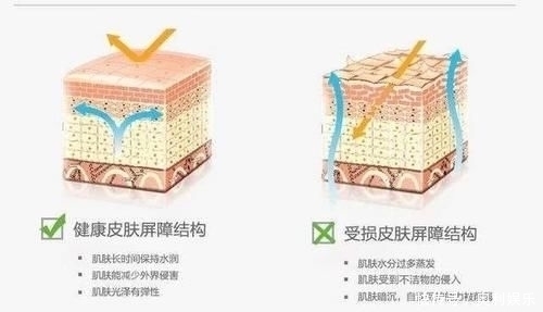  真的|3款容易“踩雷”的洗发水，用后头痒又起头皮屑，没用过真的幸运