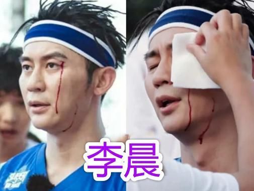 邓超|明星参加综艺节目有多危险邓超打石膏、baby骨折,而他血流不止