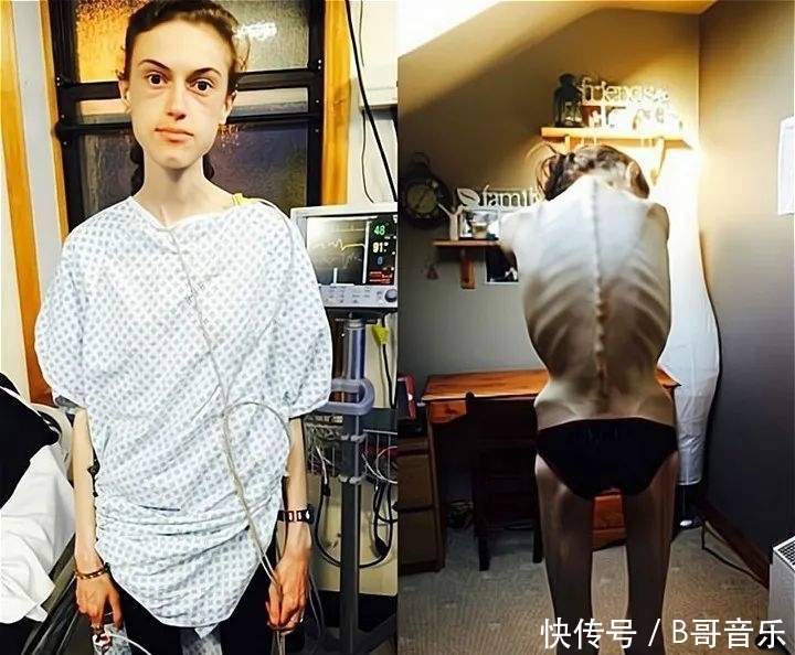 减肥|那个拼命减肥的女孩，后来为长肉拼命