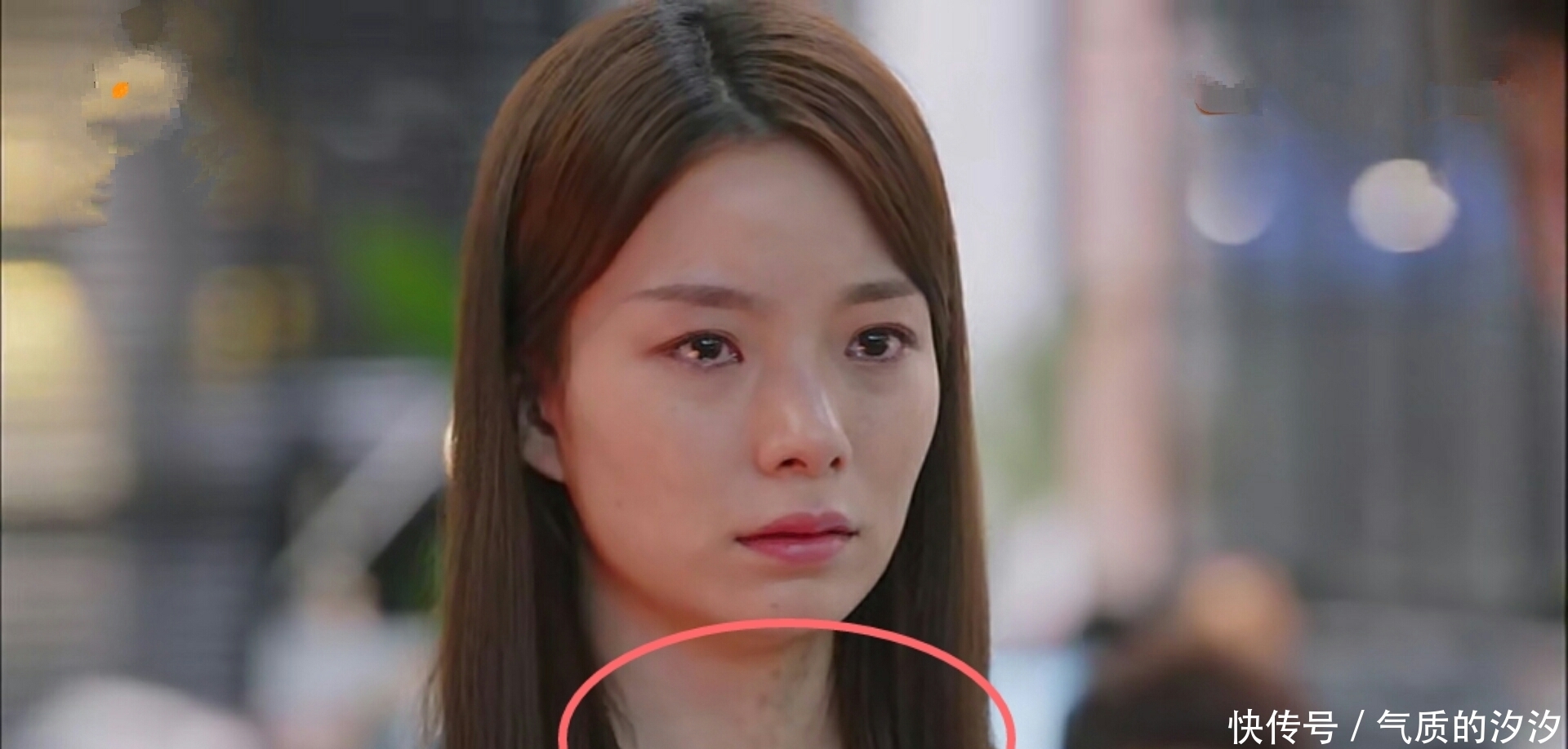 亲爱|《亲爱的自己》:林玲的扮演者陈卓璇,毫不掩饰的胎记是认真的吗