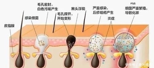  真的|3款容易“踩雷”的洗发水，用后头痒又起头皮屑，没用过真的幸运