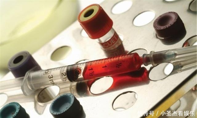  女子|单身女子为何也能感染上艾滋病？医生：她可能做了这3件事