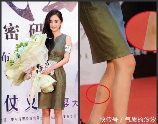 亲爱|《亲爱的自己》:林玲的扮演者陈卓璇,毫不掩饰的胎记是认真的吗