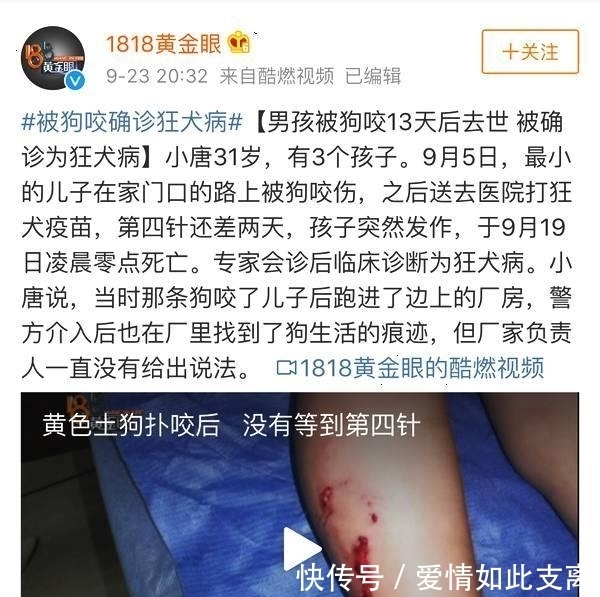  疫苗|为什么男孩被狗咬伤后, 打了三针狂犬病疫苗后, 还会发病身亡?