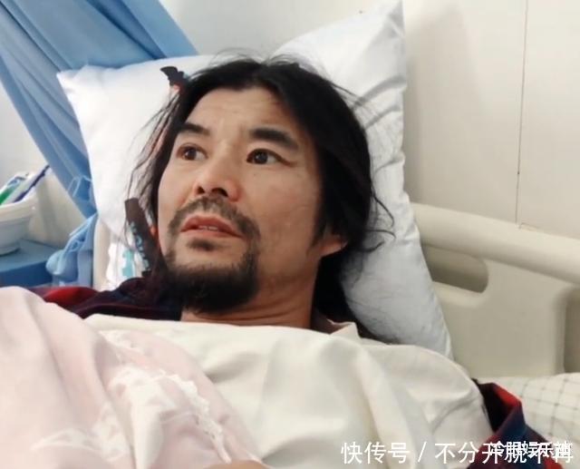  肺癌|“面筋哥”程书林肺癌晚期却瞒着家人，带病录歌让人看着心酸