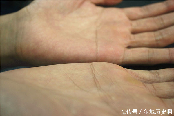 生病|肺生病了，手和脸会出现“怪像”，如果你一个不占，肺还健康