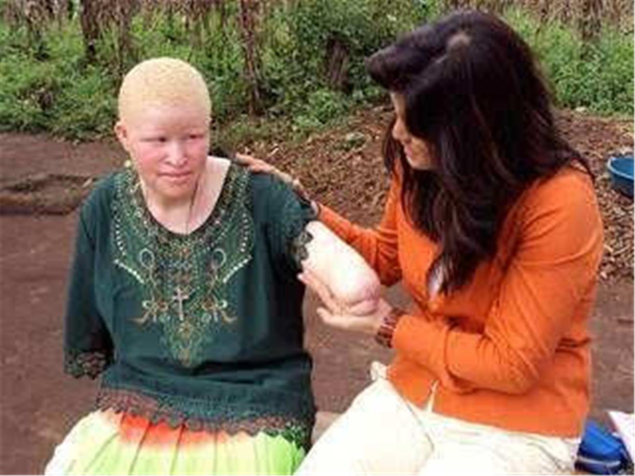 堪比|非洲最“精贵”的人,血液堪比黄金,不少人为他们的身体铤而走险