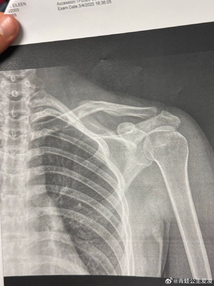 t11508c75c871a4b89c0023f307.jpg?size=690